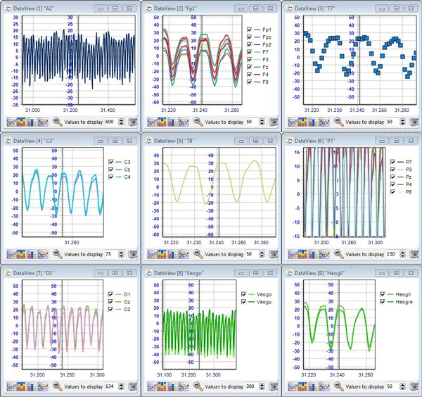 DataView software showing physiological measurements