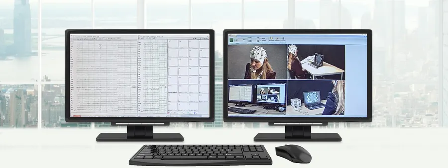 Integration of EEG data into Observational Studies