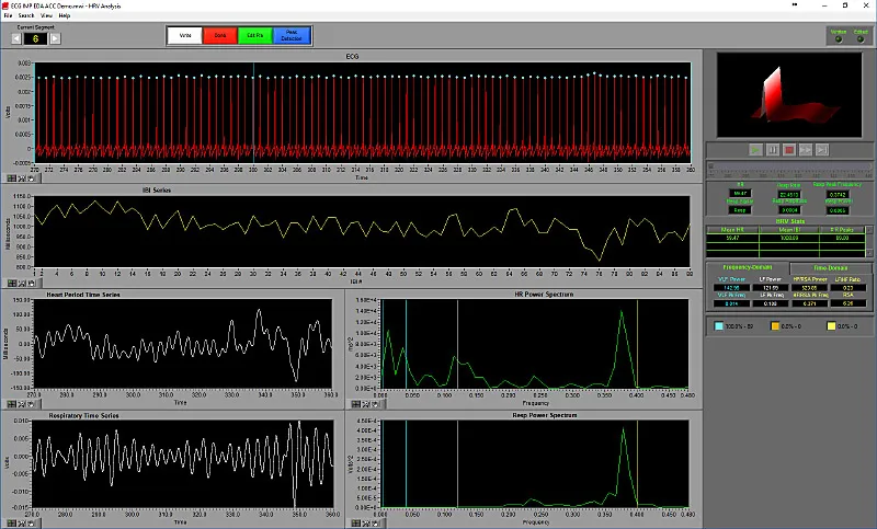 MindWare HRV analysis software