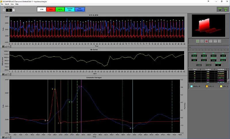 MindWare IMP analysis software