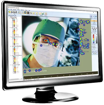 MangoldVision monitor showing eye tracking interface