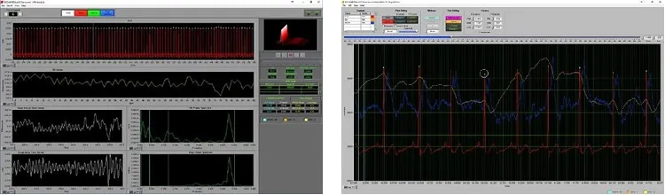 MindWare data analysis software screenshot